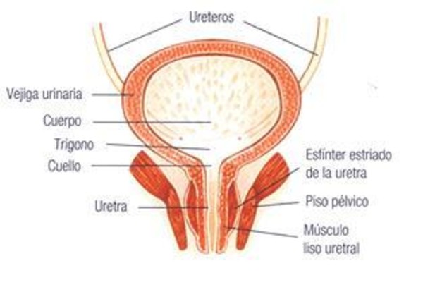 TRATAMIENTO NATURAL DE LA CISTITIS INTERSTICIAL